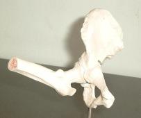 hip joint